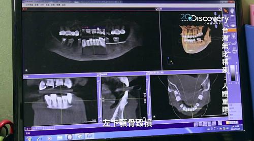 Taiwan Revealed – Body Reconstructed 